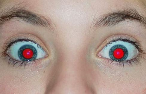 Eye pissing pink eye - Adult Pictures HQ Tasa midget a